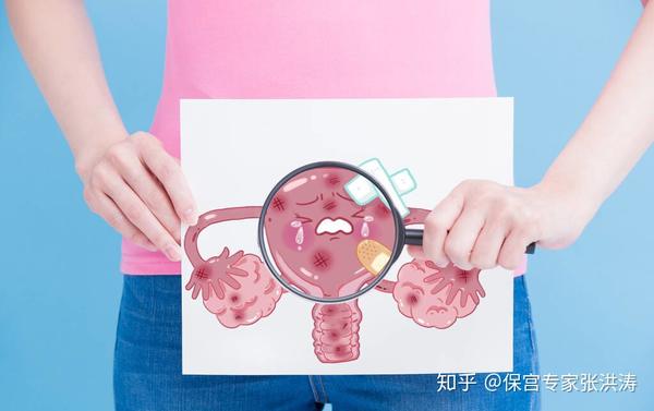 不疼不痒查出卵巢癌,很难理解?其实你身体早已发出了3