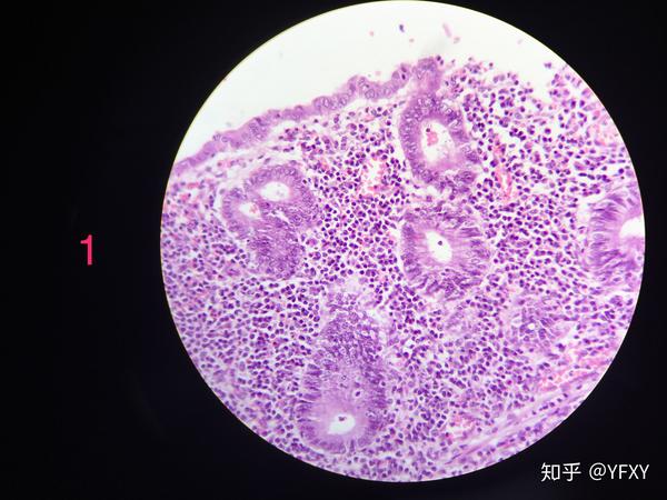 病理学 红蓝铅笔绘图