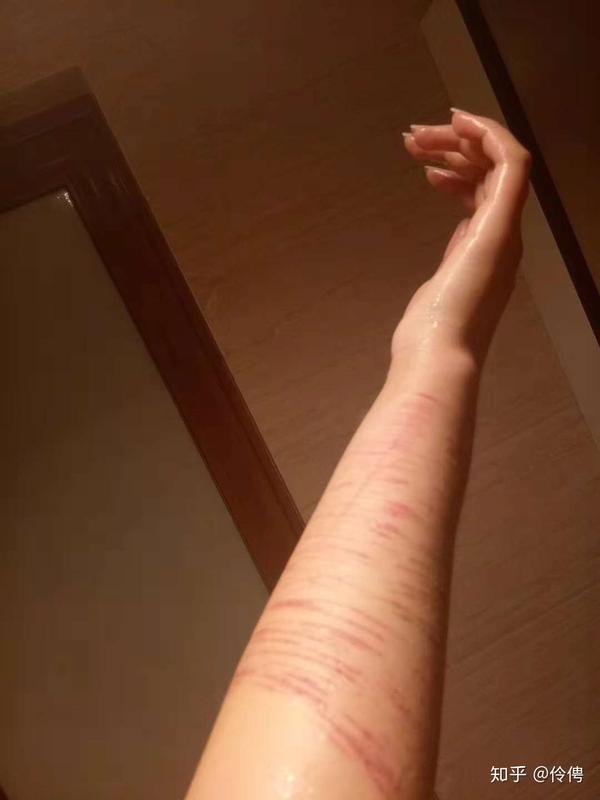 你被抑郁症折磨成什么样子了呢?