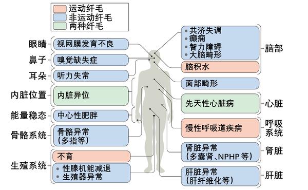 运动纤毛与非运动纤毛异常导致的疾病类型(翻译自参考文献 [4])