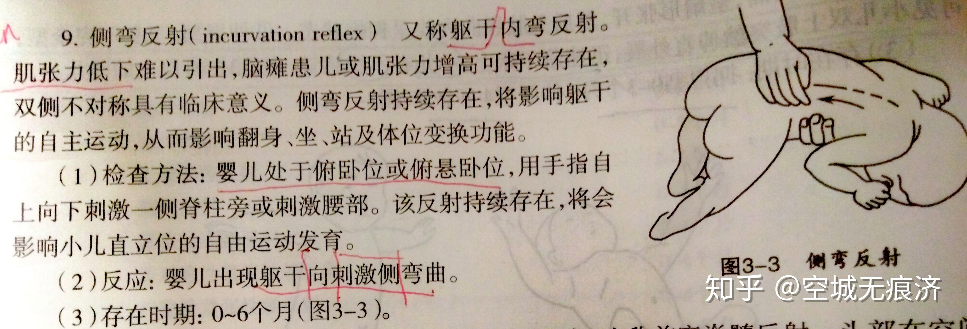 8.侧弯反射又称躯干内弯反射.(3) 存在时期:0-6周.