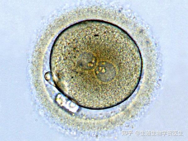 通过两个原核(一个来自卵子,一个来自精子)在显微镜下可以看到成功的