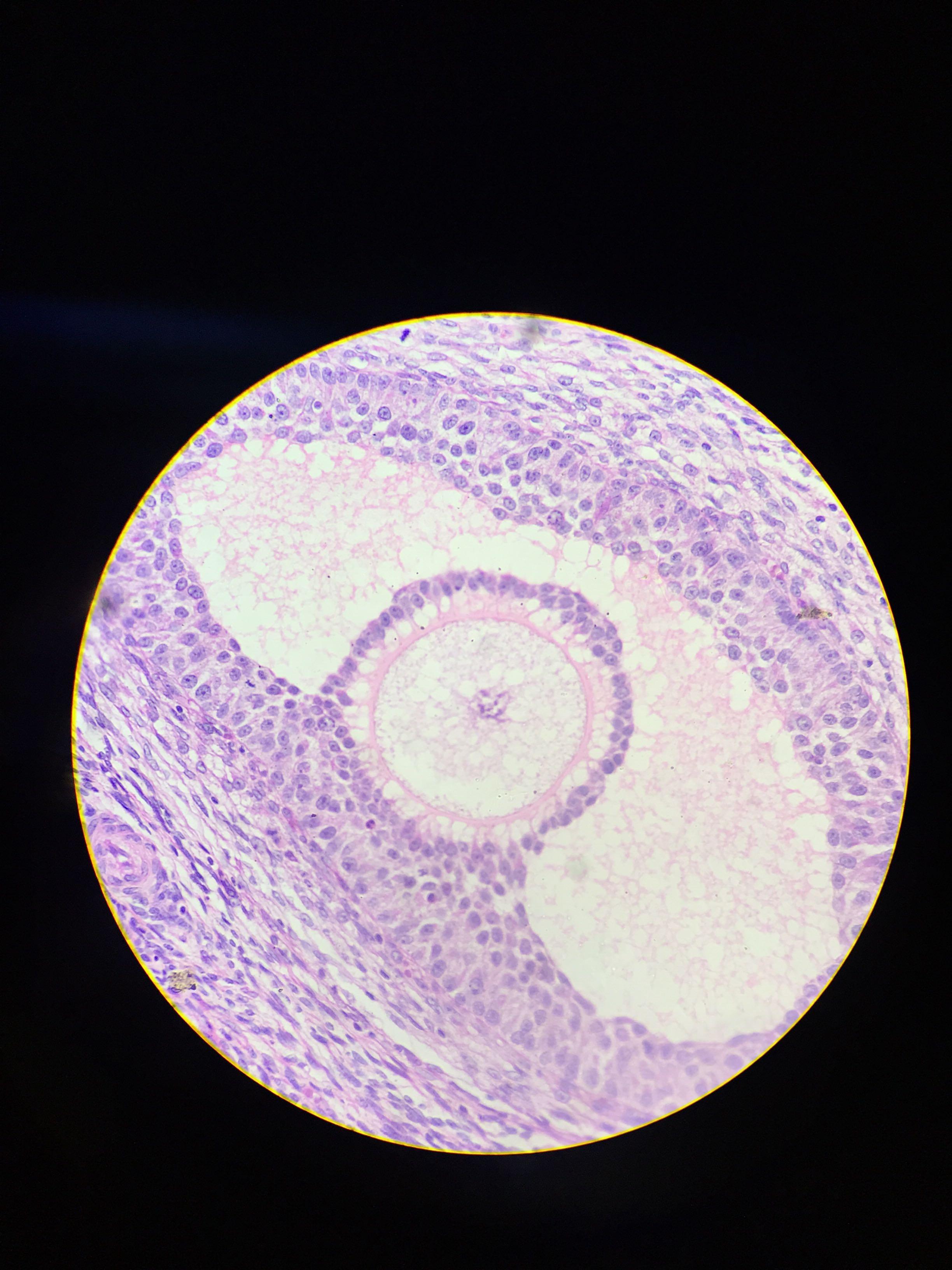 是卵泡,总感觉像一只眼睛盯着我=_= 还有粉红色少女心的甲状腺滤泡