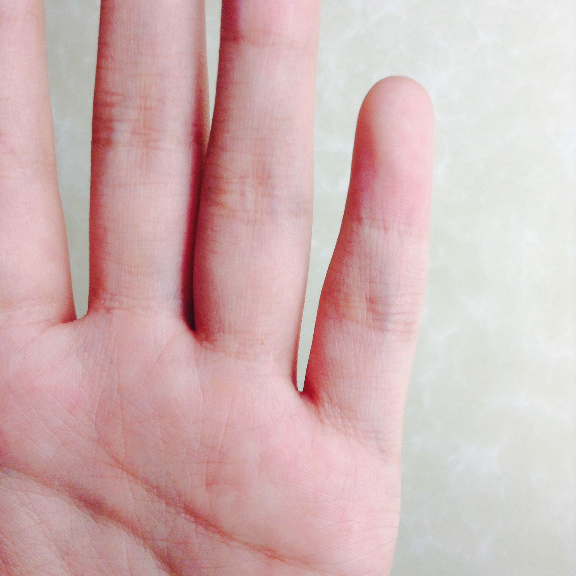 我小拇指天生是歪的,而且比别的手指短很多,是不是不适合弹吉他?