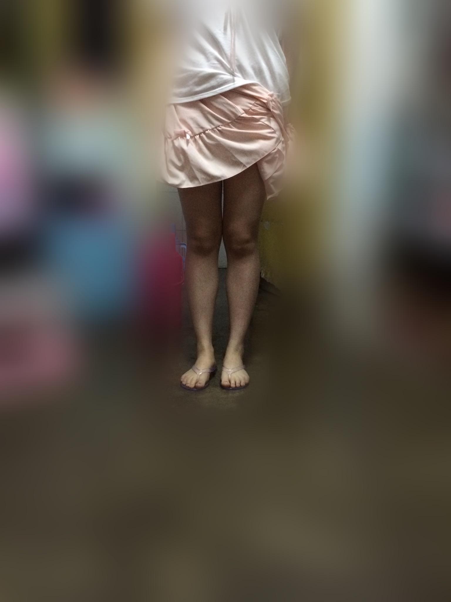 小腿特别粗和其他部位不协调怎么办? - 健身 - 