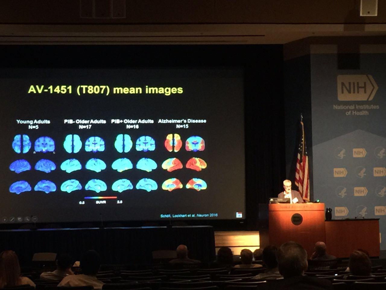 marilyn albert介紹了biocard (predictors of cognitive decline