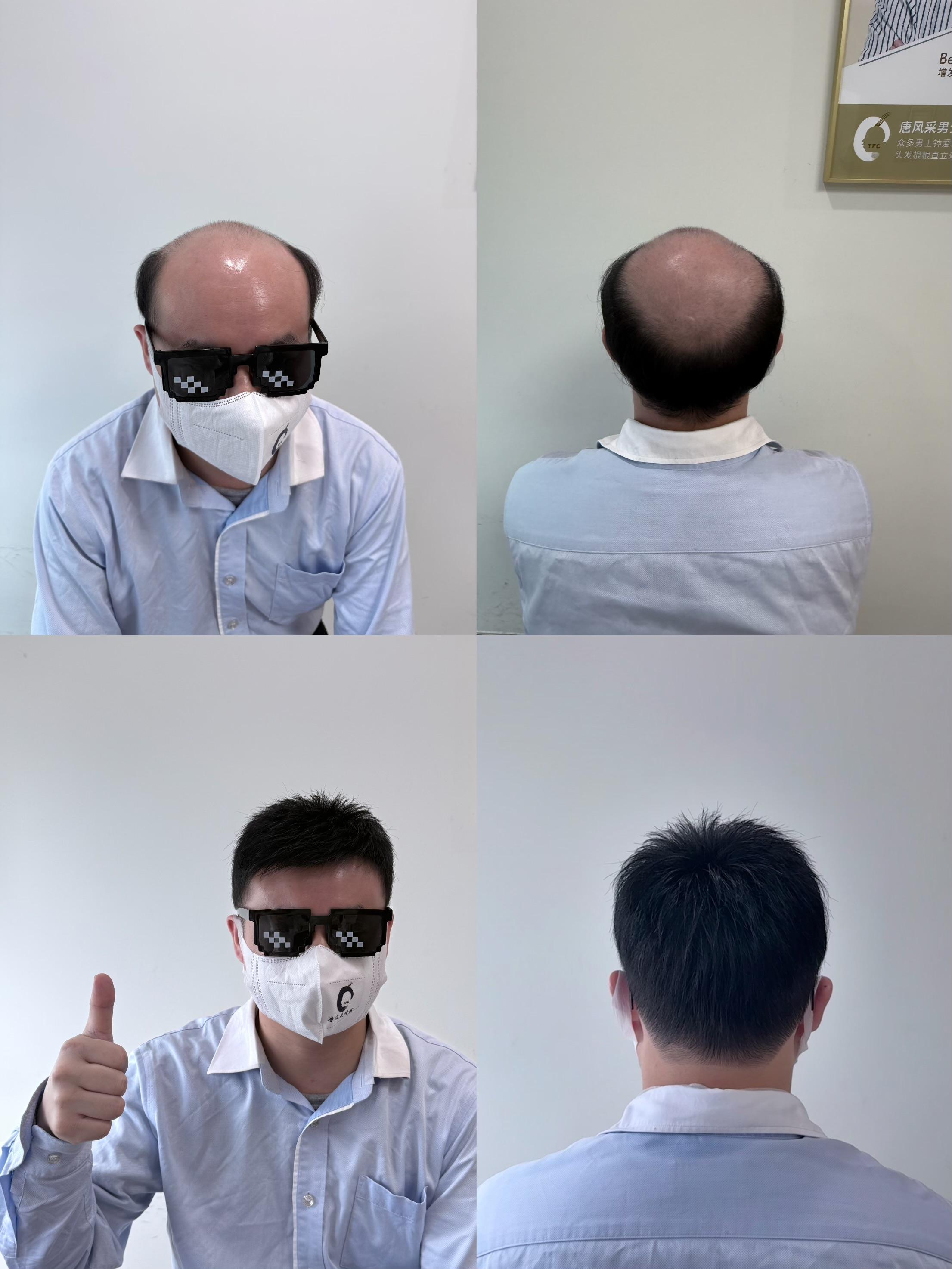 跨越百里,从永州奔赴的"新生":秃头大叔的华丽变身在永州的街头巷