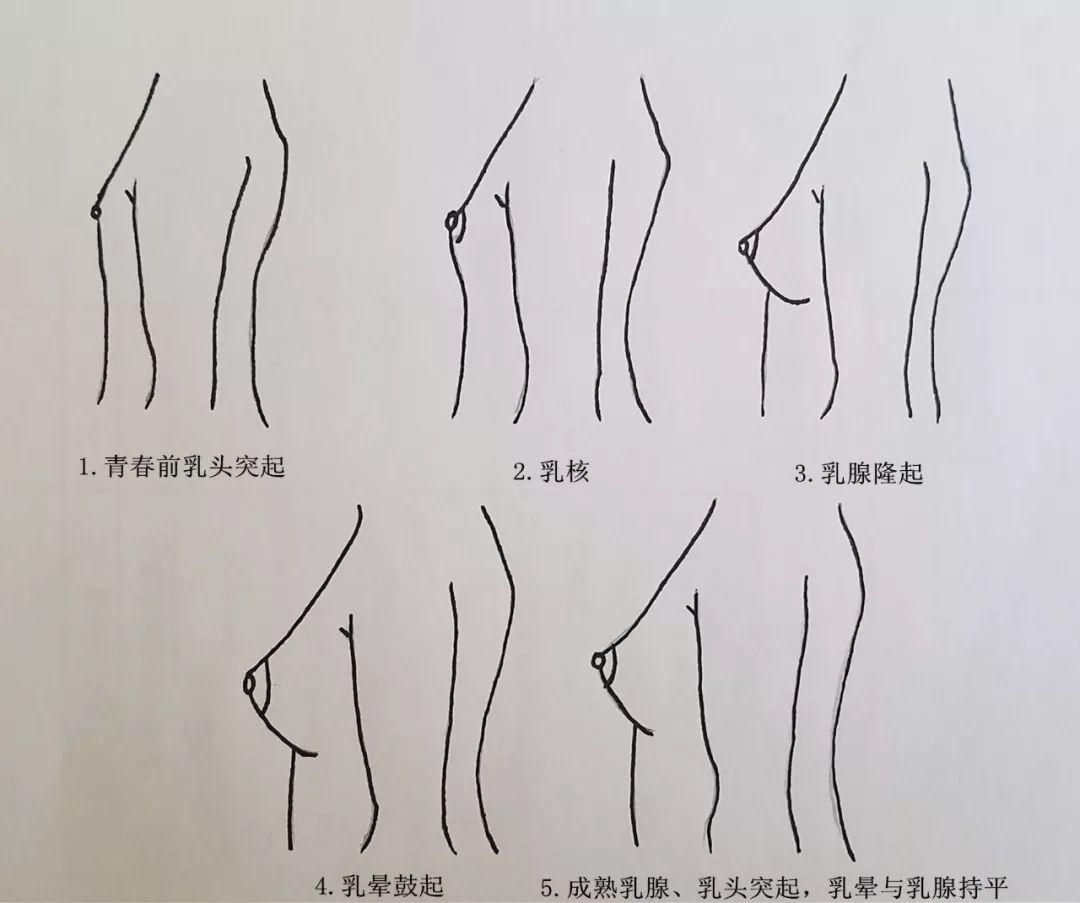 广慧 生殖医生 的想法: 乳房一大一小是怎么回事?