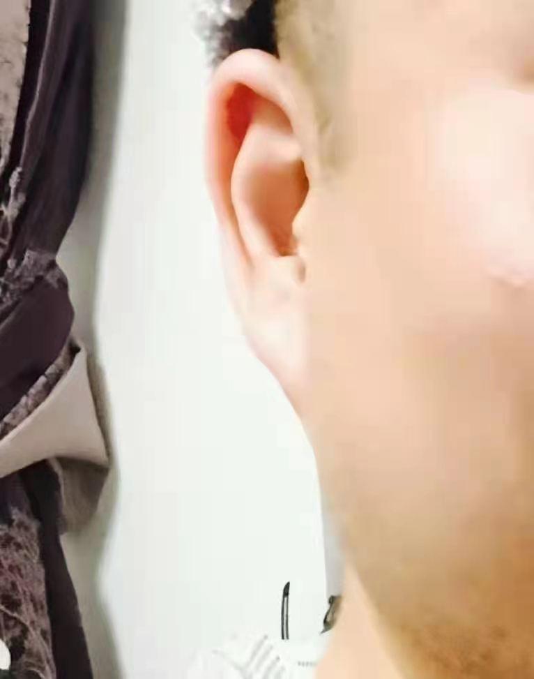 鸡嘴耳鸡嘴耳厚实有肉自小成长顺利福气不会太差但如果是薄耳容易家庭