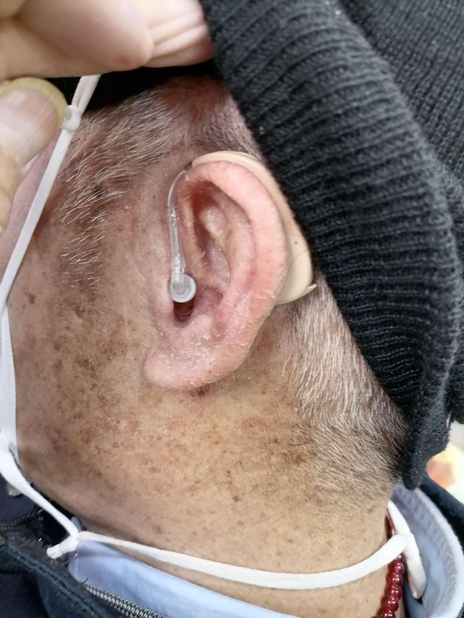 新城助听器 的想法: 助听器适应的人群?