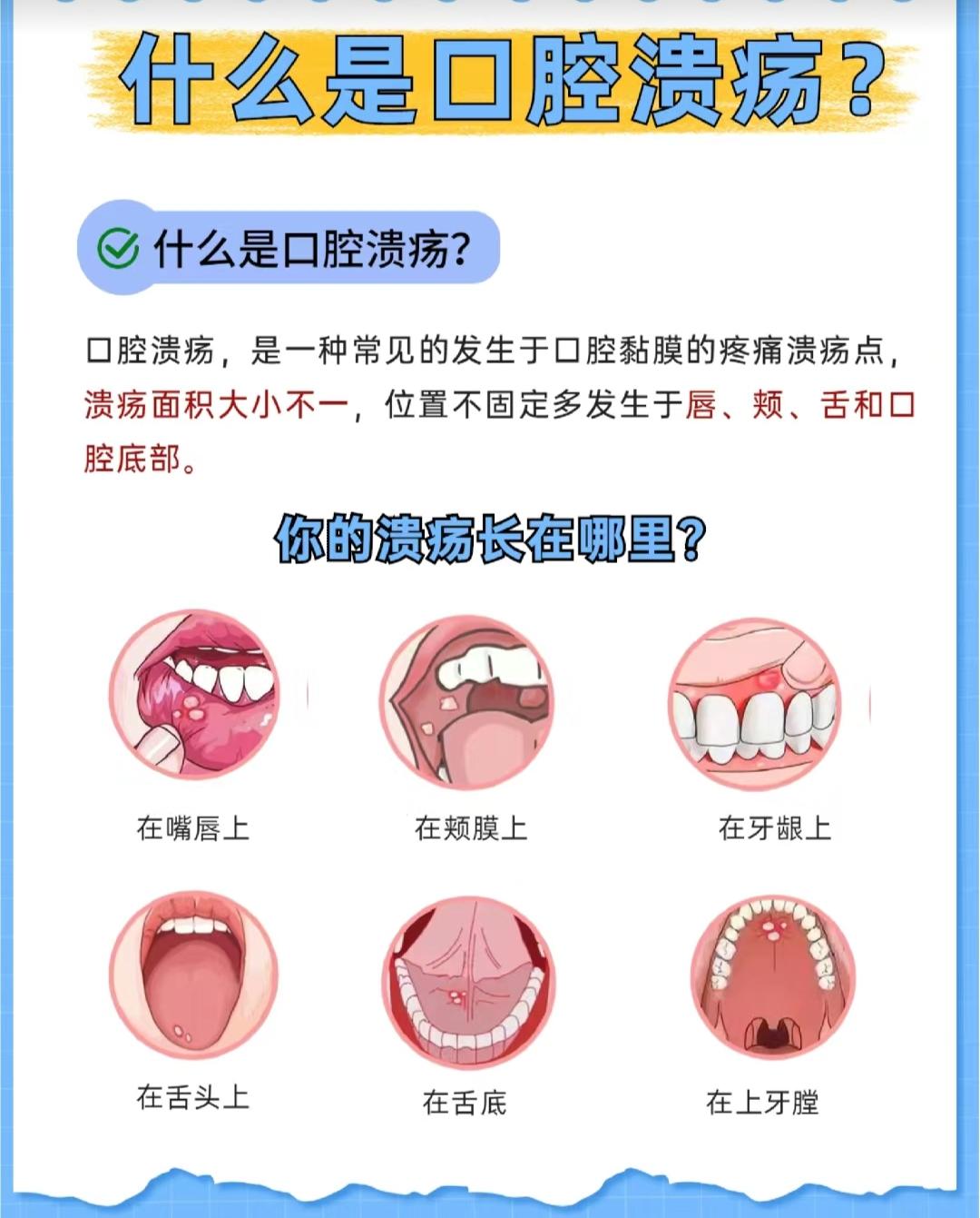 氨来呫诺糊剂图片