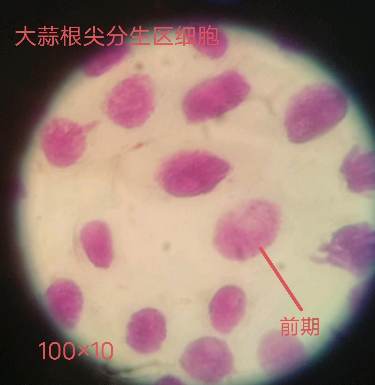 又见无边落 的想法: 有丝分裂