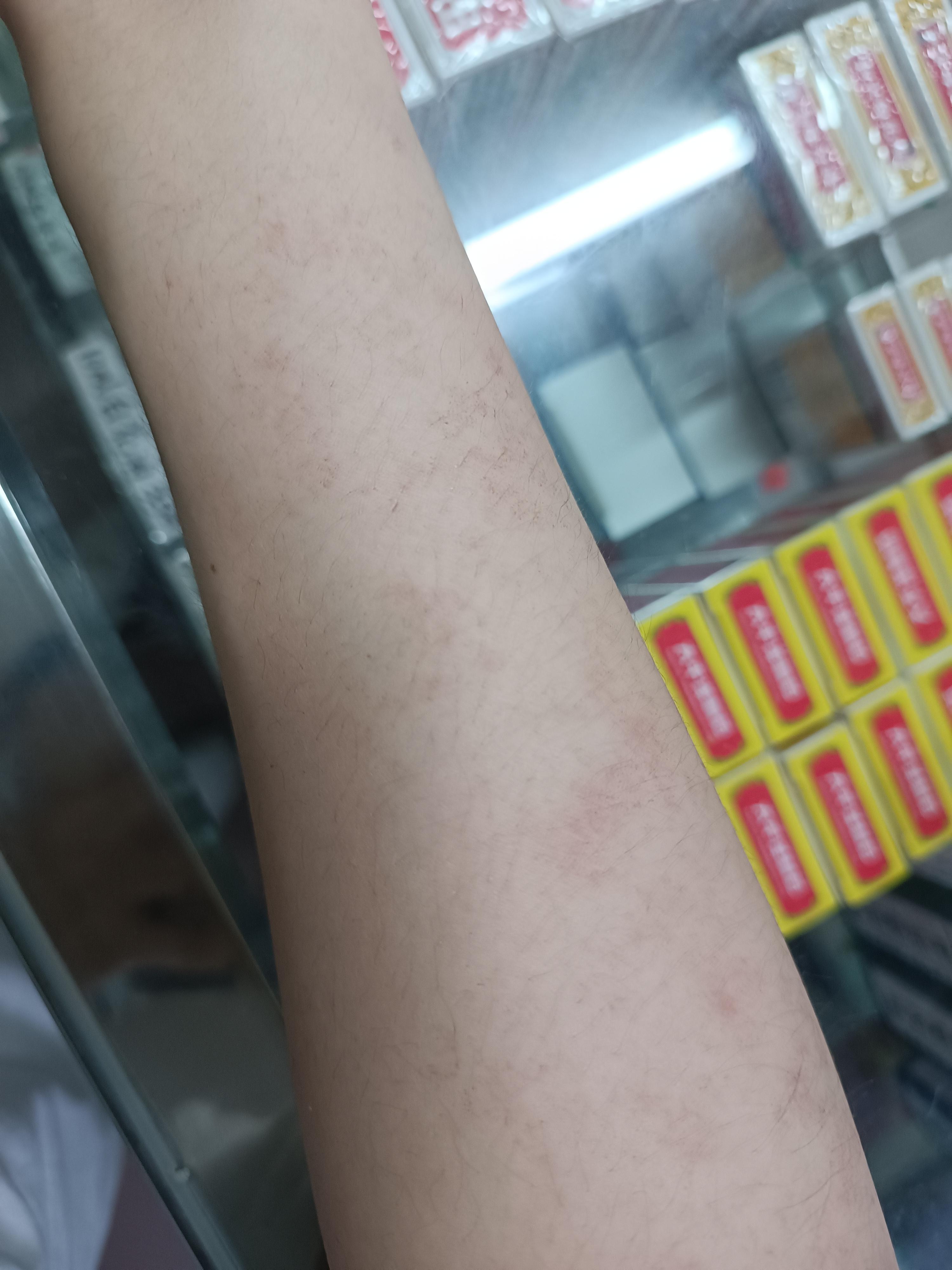 为什么手臂上有很多很小的点 为什么手臂上有很多很小的点