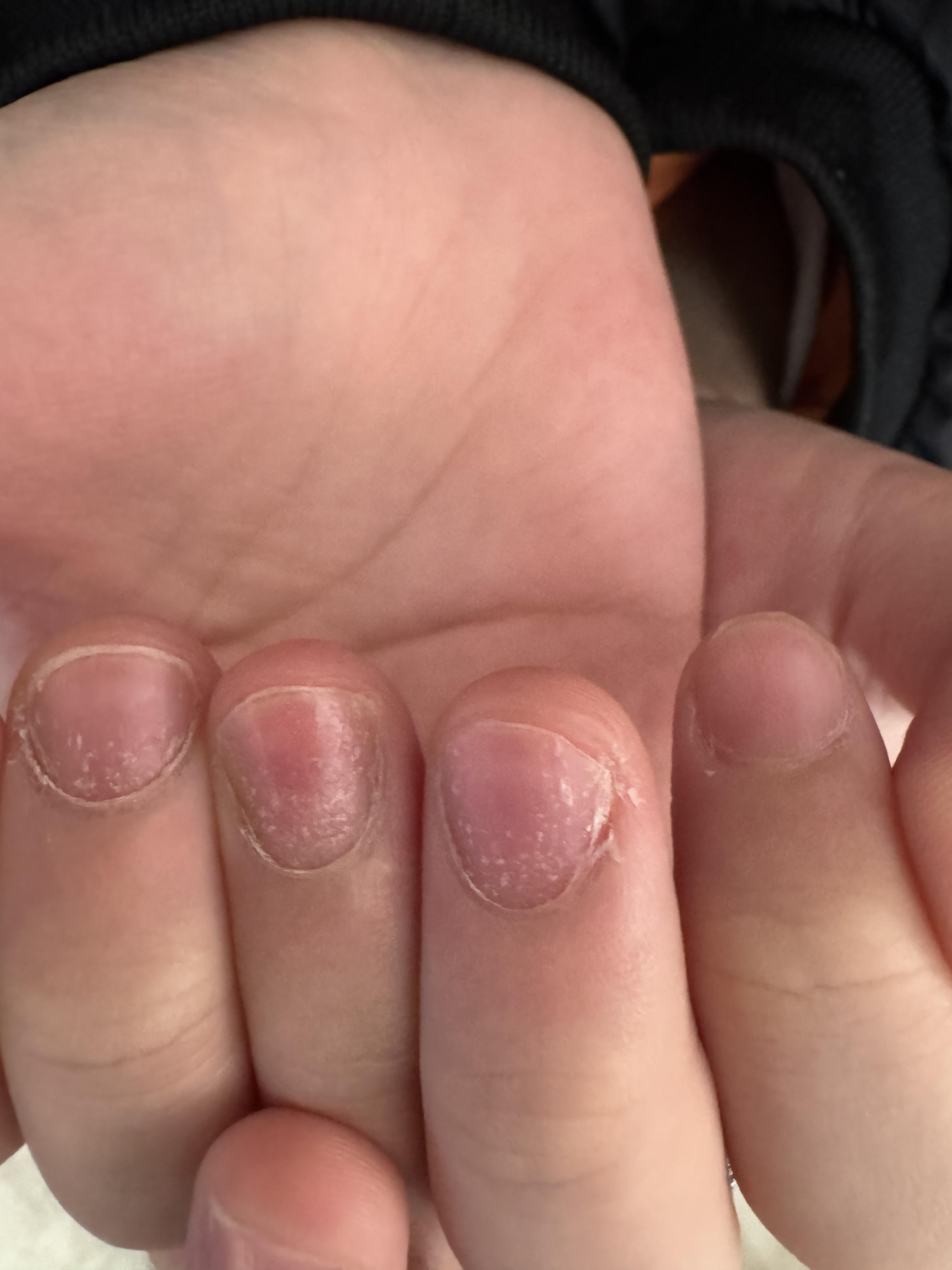 无论是点状白甲还是部分