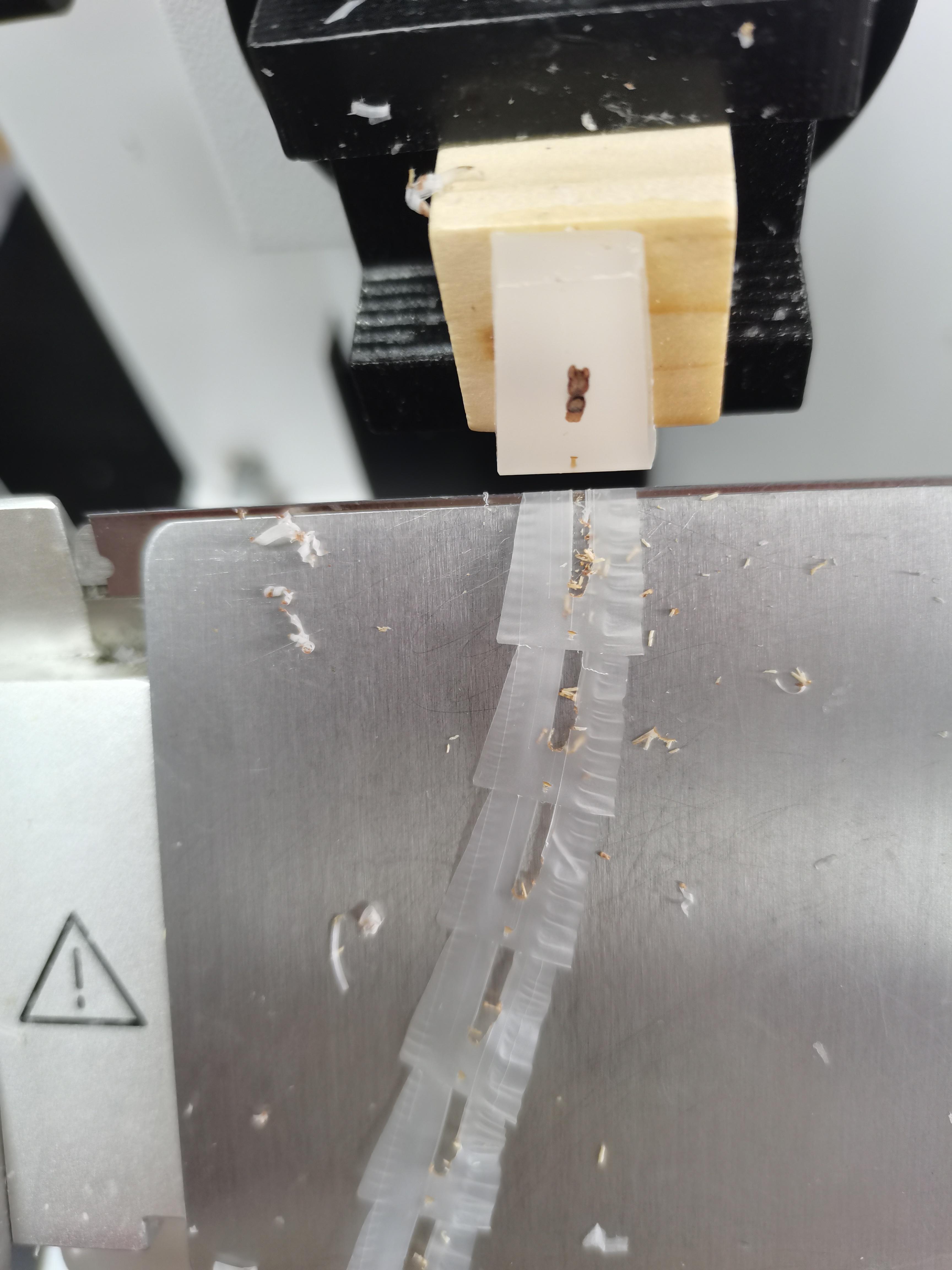 有么有大神知道出现下图的石蜡切片是怎么回事?