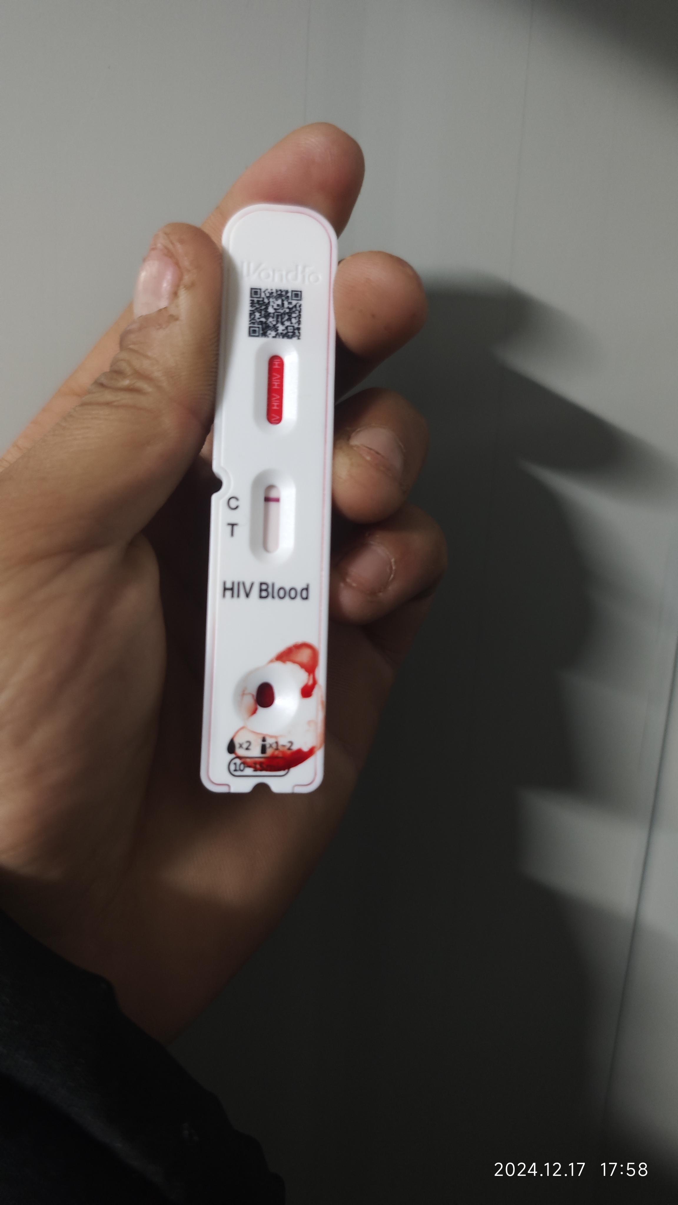 hiv,t线侧着看着有条白线,是包埋线吗,各位大神们求解答