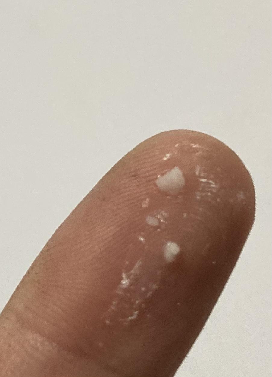 千跃沐晴 的想法: 今吃了豆腐,小便最后尿出来这种白色颗粒,用手碾碎