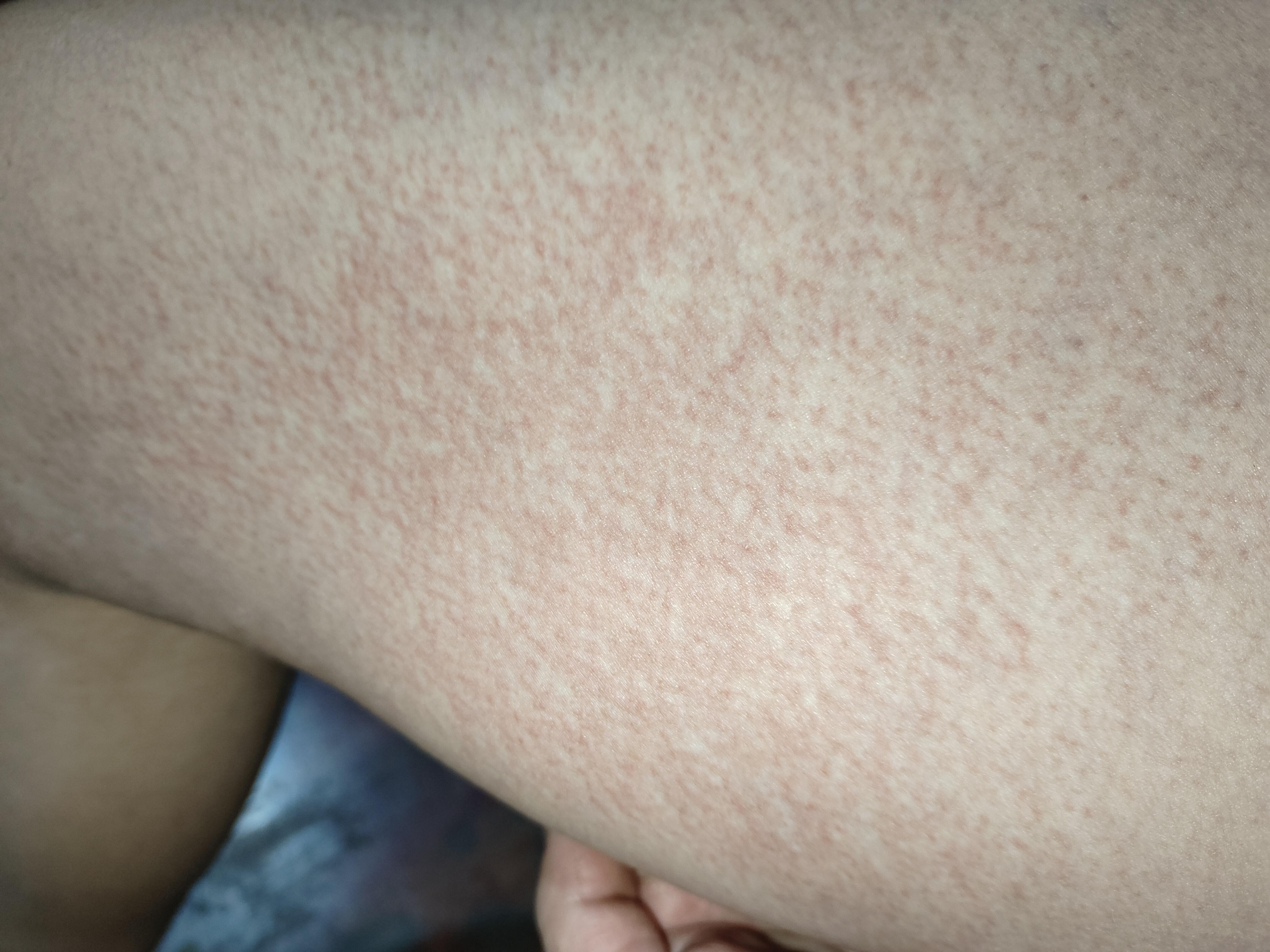 上皮肤爱笑的乌龟登录/注册切换模式等你来答知乎知学堂焕新知乎直答