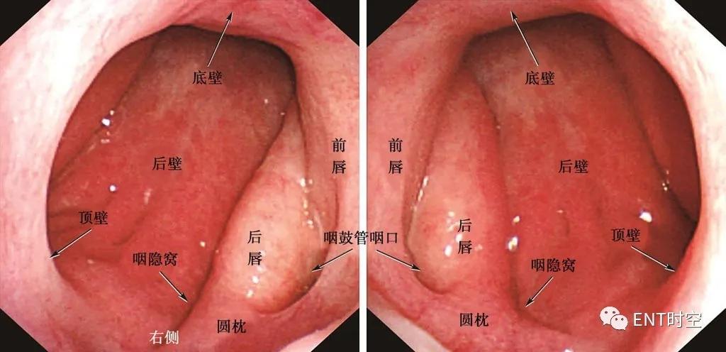 正常的鼻咽部平面图片图片