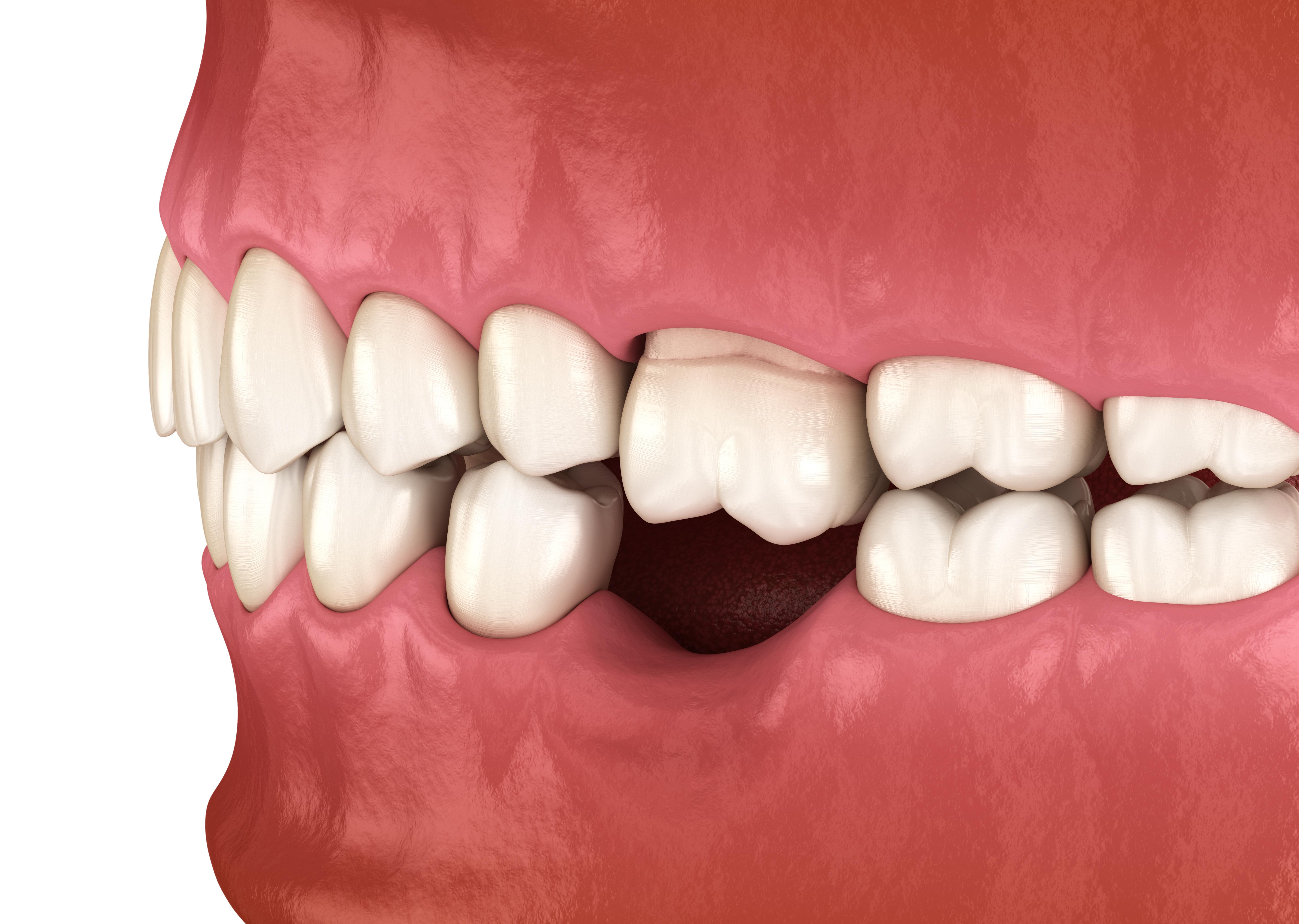 我前段时间也感觉牙齿松