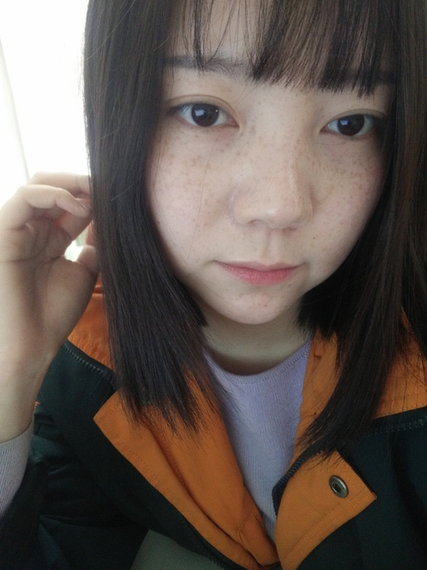 在中国,长雀斑会一点一点瓦解一个女孩的信心吗?