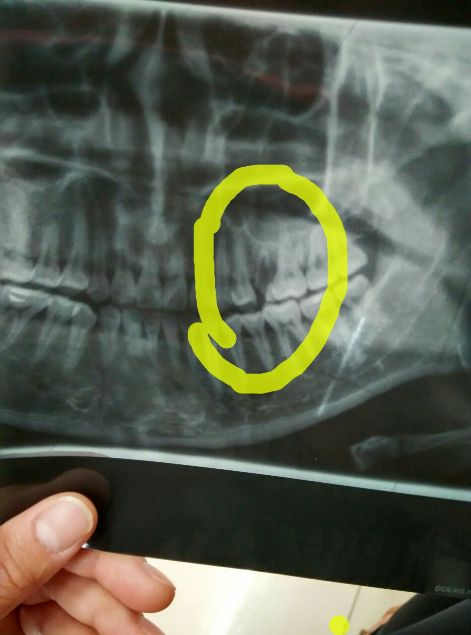 牙科x光片 ?