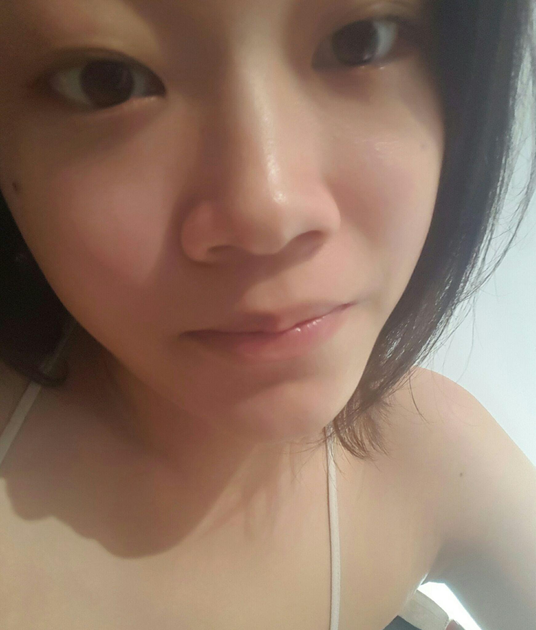 为什么我每天喝了很多水嘴唇仍然发干起皮,甚