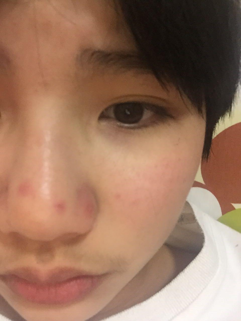 美丽加芬护肤品怎么样?茶树洁面那个怎么样?