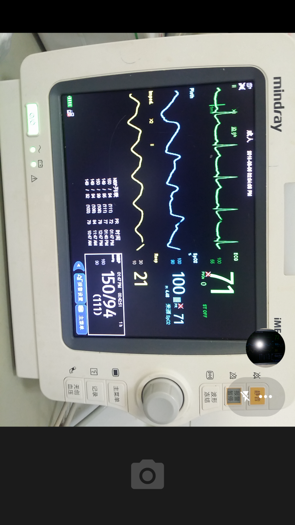 医院用的监护机上的几个英文简写什么意思?