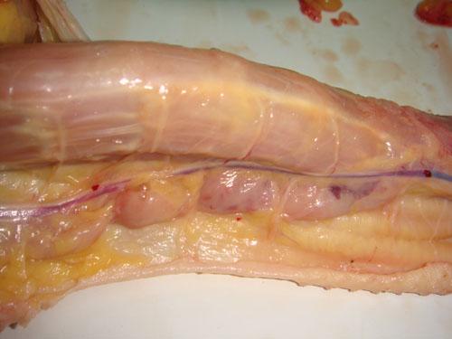 脖子皮下那一坨坨的玩意虽然长得像淋巴结,但它确实不是淋巴结,是胸腺