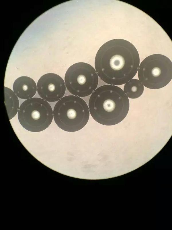 图为iphone拍摄的倒置显微镜图. 利益相关:211大学.学过微生物学检验.