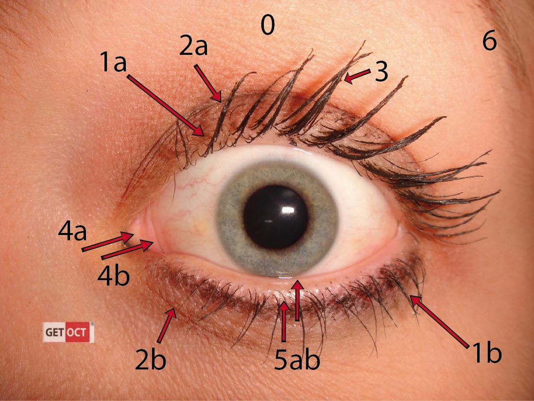 upper eyelid; palpebra superior(面:上眼皮) 1b.