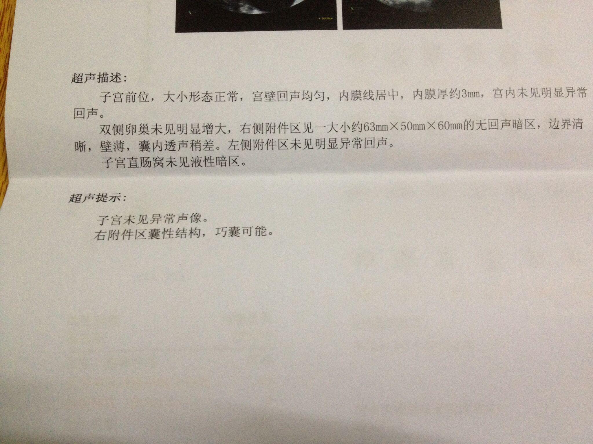 囊肿化验单图片图片