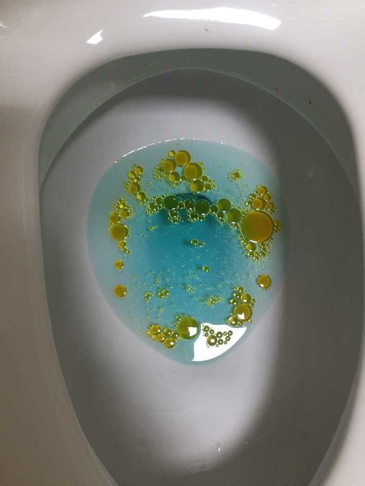 有人吃过奥利司他片么?效果如何?