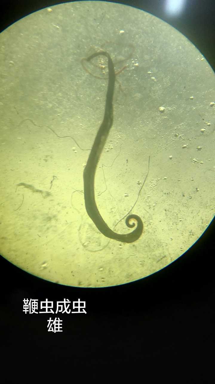 寄生虫病有多可怕 知乎 寄生虫病有多可怕 知乎
