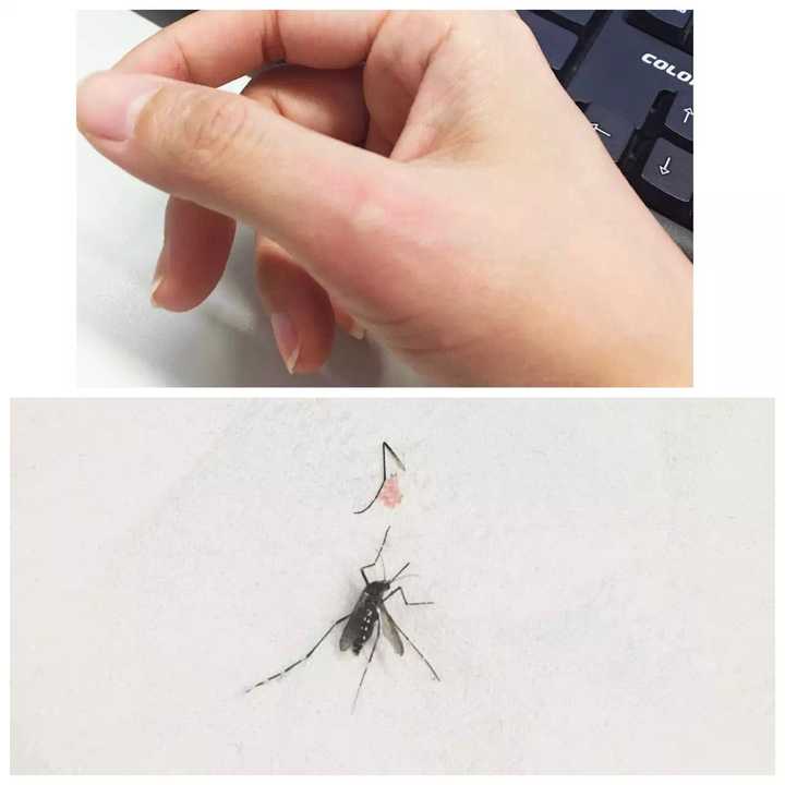 虐待蚊子都有什么奇技淫巧?