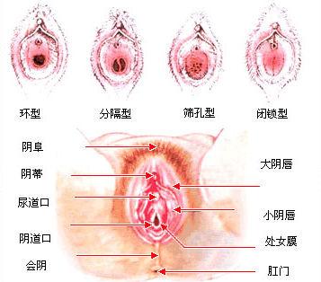 阴道跟尿道是一个孔吗 具体位置是怎么样的 知乎