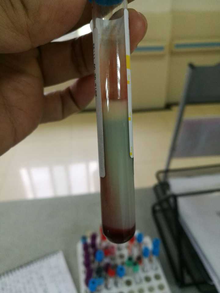 可乐天天当水喝,可乐上瘾是一种怎样的体验?