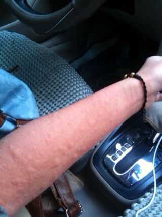 为什么总能看到美国人发生花生过敏的报道,但