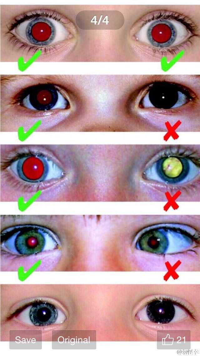 生活中有哪些容易被忽视的细节,实际是重大疾病或灾祸的征兆?