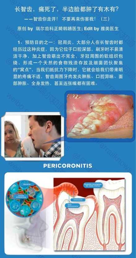 智齿一定要拔掉吗 知乎