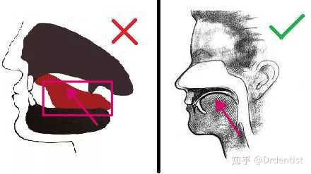 吞咽时候舌头的正确位置