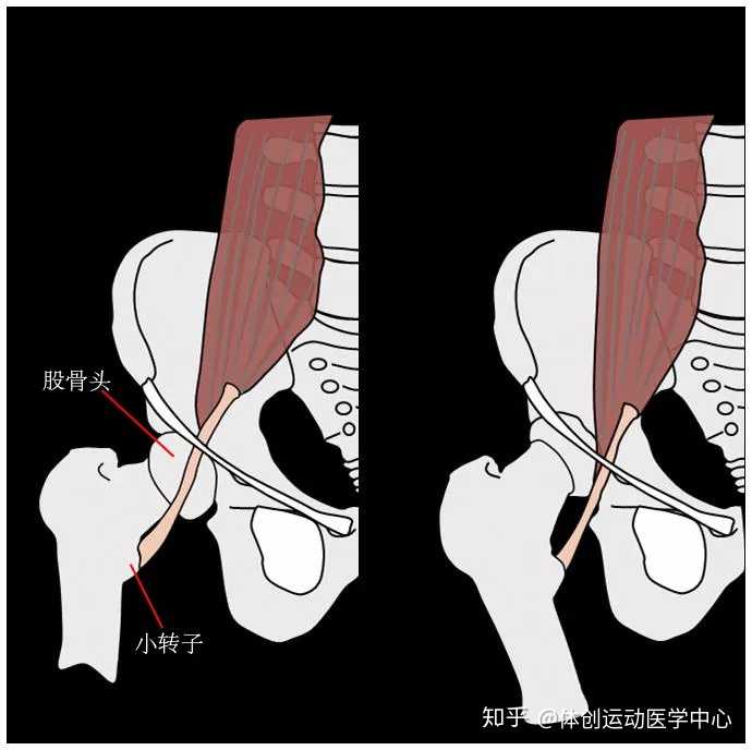 髖關節為什麼彈響?