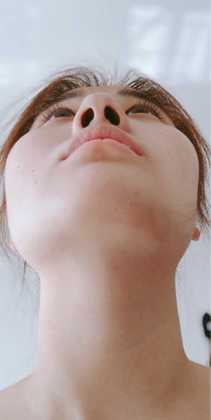 下颌骨磨骨/削骨整形是一种怎样的体验?