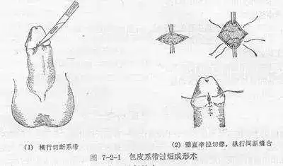 系带 知乎