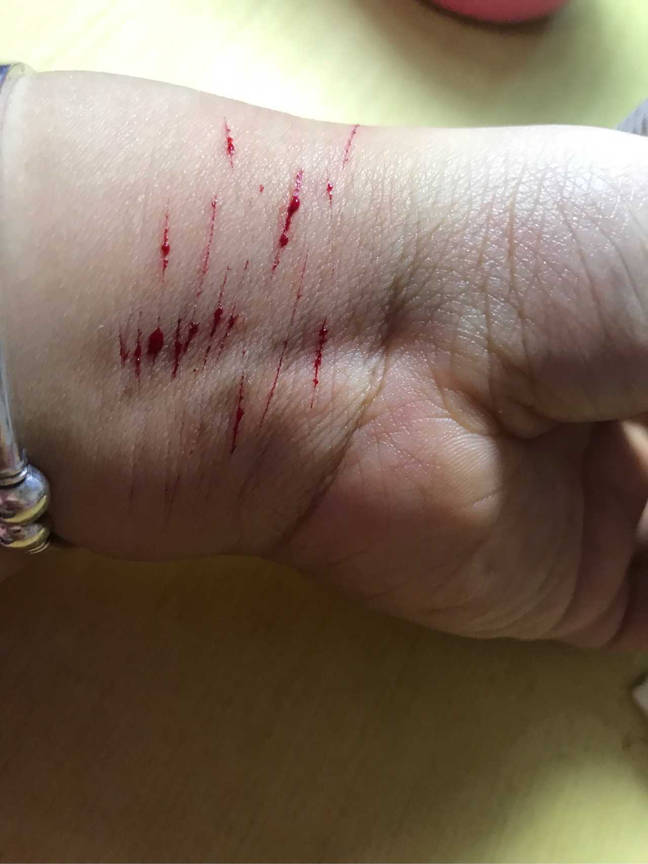 又把手腕给割了一条一条的口子,有那么一点点刺心地疼,心里舒服多了