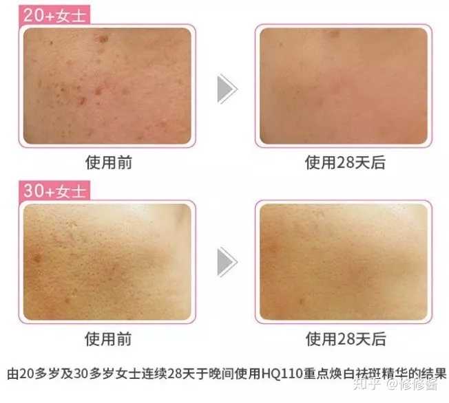 有哪些用了绝对不后悔日系护肤品 知乎 有哪些用了绝对不后悔日系护肤品 知乎