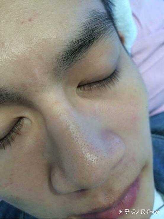 男士去黑头效果好的的护肤产品什么比较好 知乎 男士去黑头效果好的的护肤产品什么比较好 知乎