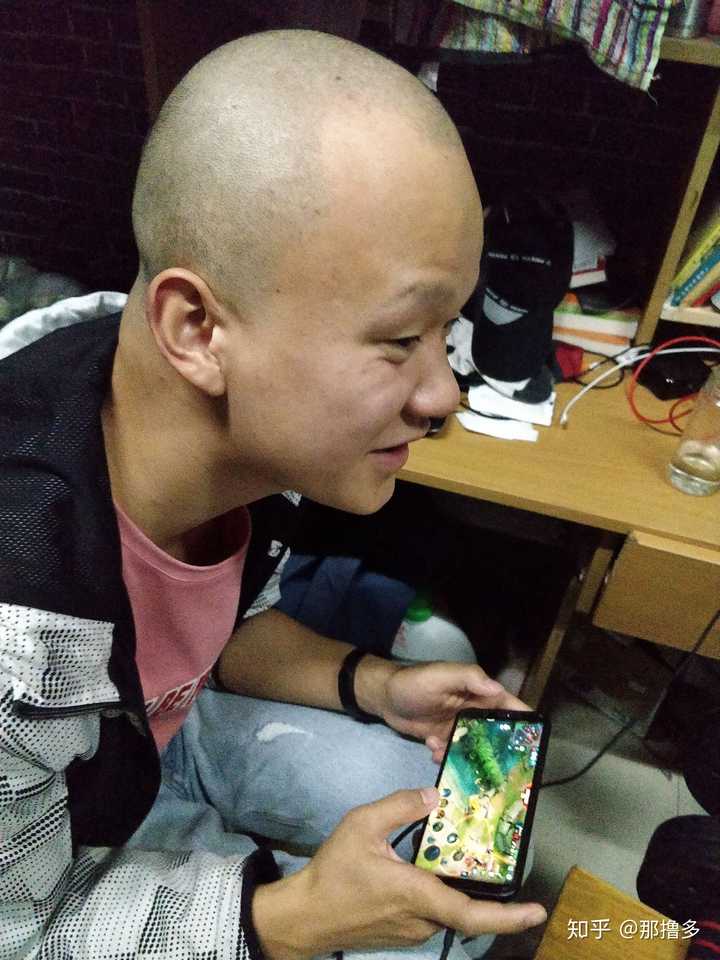 脱发,剃个光头需要多大勇气?