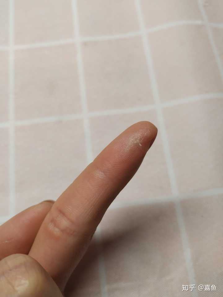 壁虎有毒吗?主要要注意它的什么东西有毒?皮肤,尿液,血还是其他?